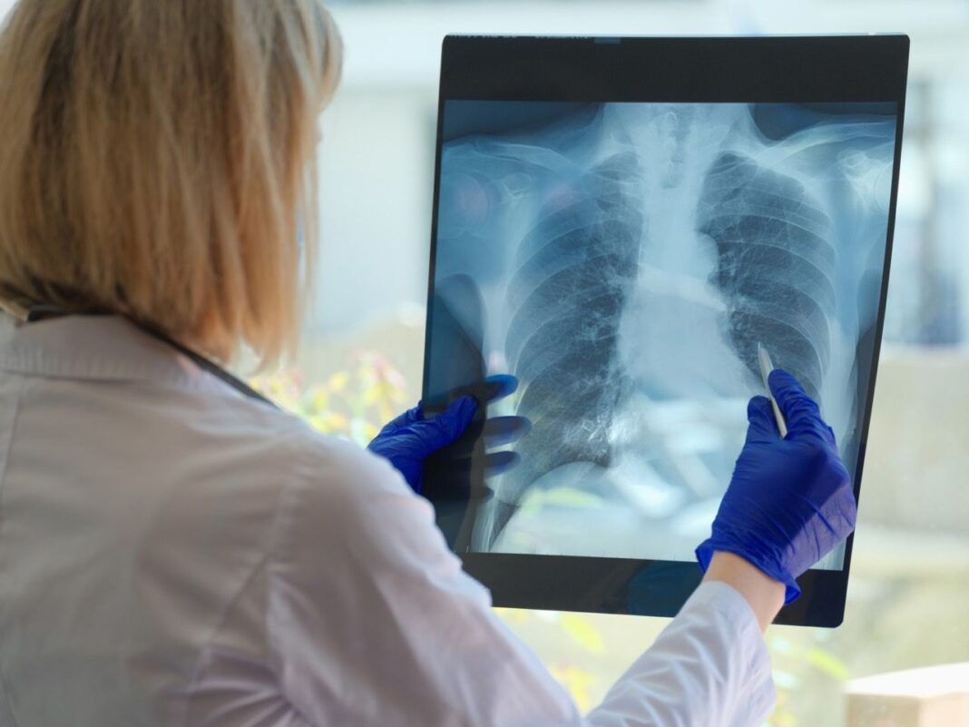 EPOC_en_tamano_grande