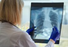 Dr. Aitor Asensi, neumológo de Policlínica Gipuzkoa: «Dejar de fumar es la medida más importante para frenar la evolución de la EPOC»